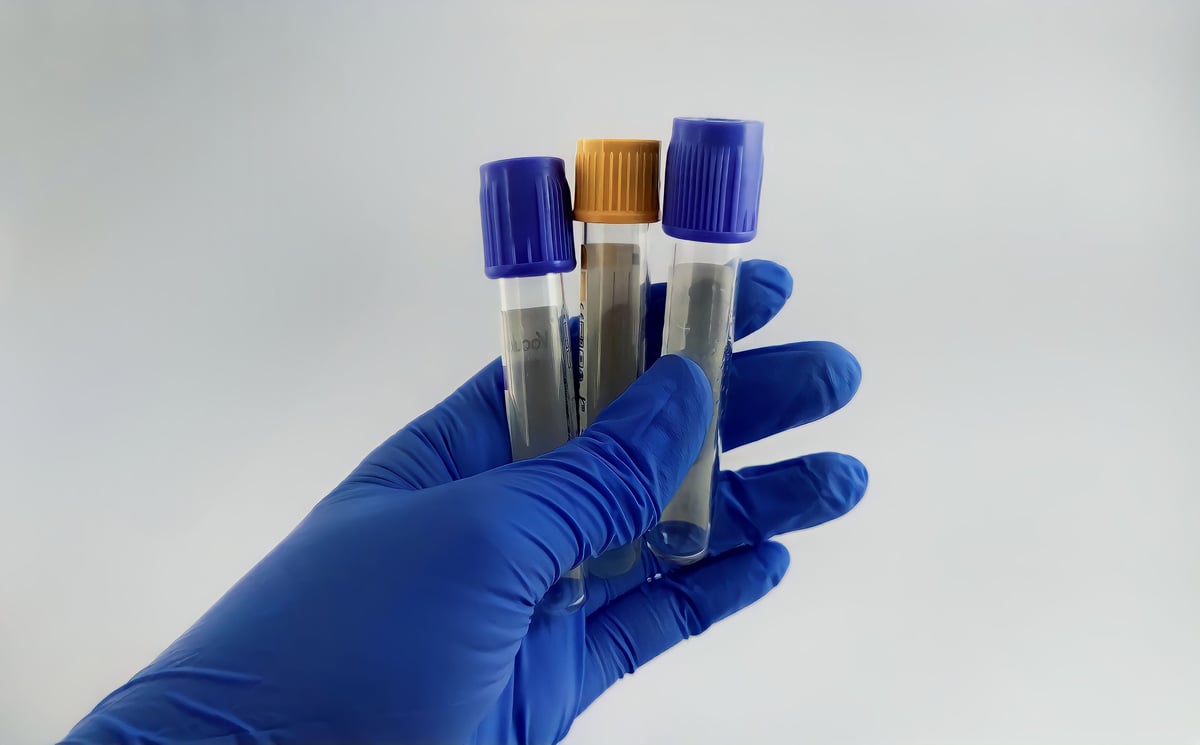 Vacuum blood collection tubes in blue gloves, showing specimen collection equipment